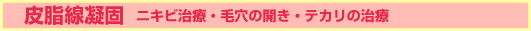 �j�L�r�̎��ÁE�ь��̊J���E�e�J���̎��Â͔玉���Ì�