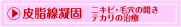 �j�L�r���ÁE�ь��̊J���E�e�J���̎��Â͔玉���Ì�
